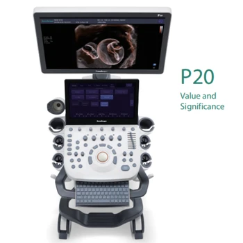 Sonoscape P20 ultraskaņas mašīna, krāsu doplera ultraskaņas skeneri pārdošanai